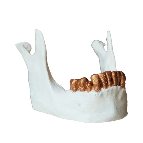 variant